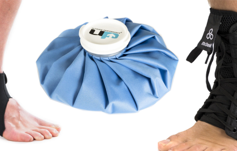Sprained Ankle: Comprehensive Recovery Guide