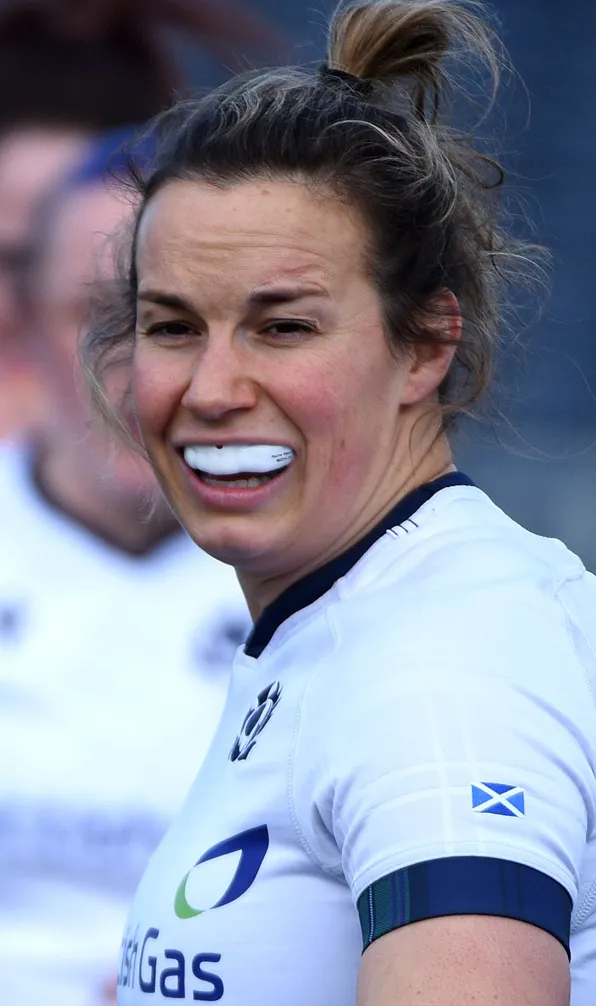 Womens Rugby Mouthguards Female rugby player shows off her mouthguard during an away match