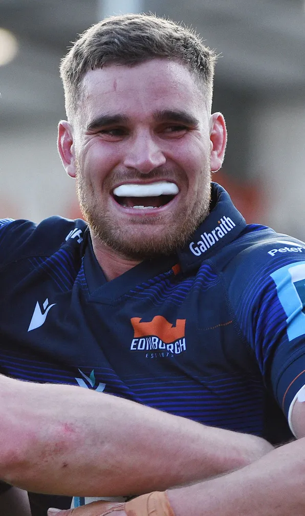 Rugby Mouthguards Edinburgh rugby player showing his mouthguard during celebrations with team mates